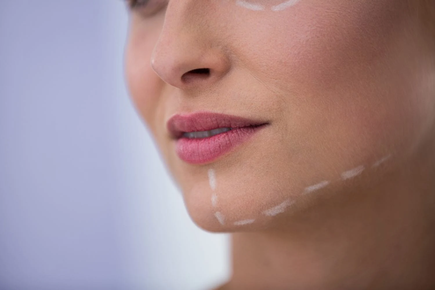 Harmonização Facial