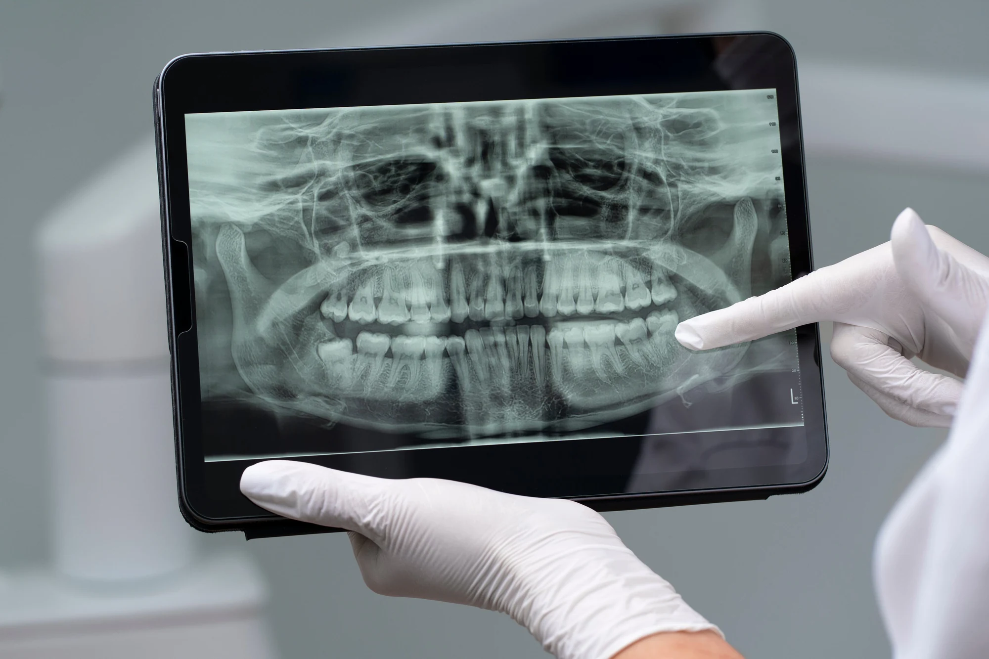Radiologia Dentária